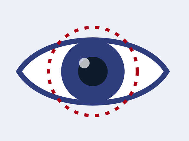 AGS Vision